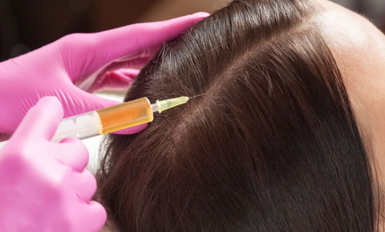 prp hair restoration cost
